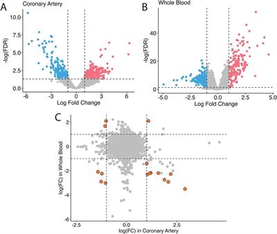 Transcriptome meta-analysis of Kawasaki disease in humans and mice